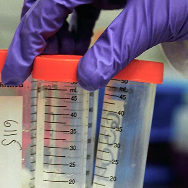 So, what’s the problem with postmortem conception?
